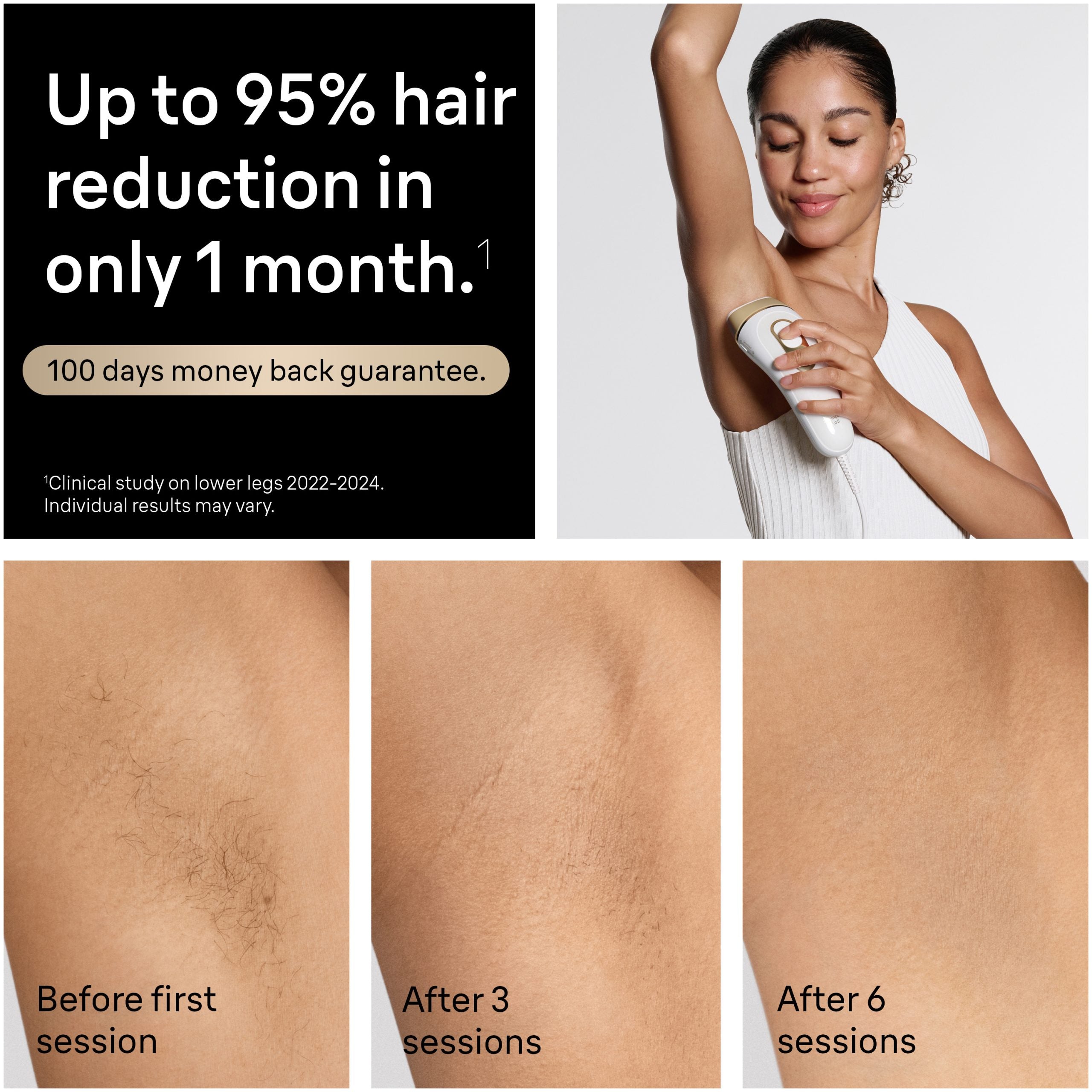 Braun Silk·expert Pro 5 IPL: Alternative to Laser Hair Removal with 4 Caps and Vanity Case PL5347