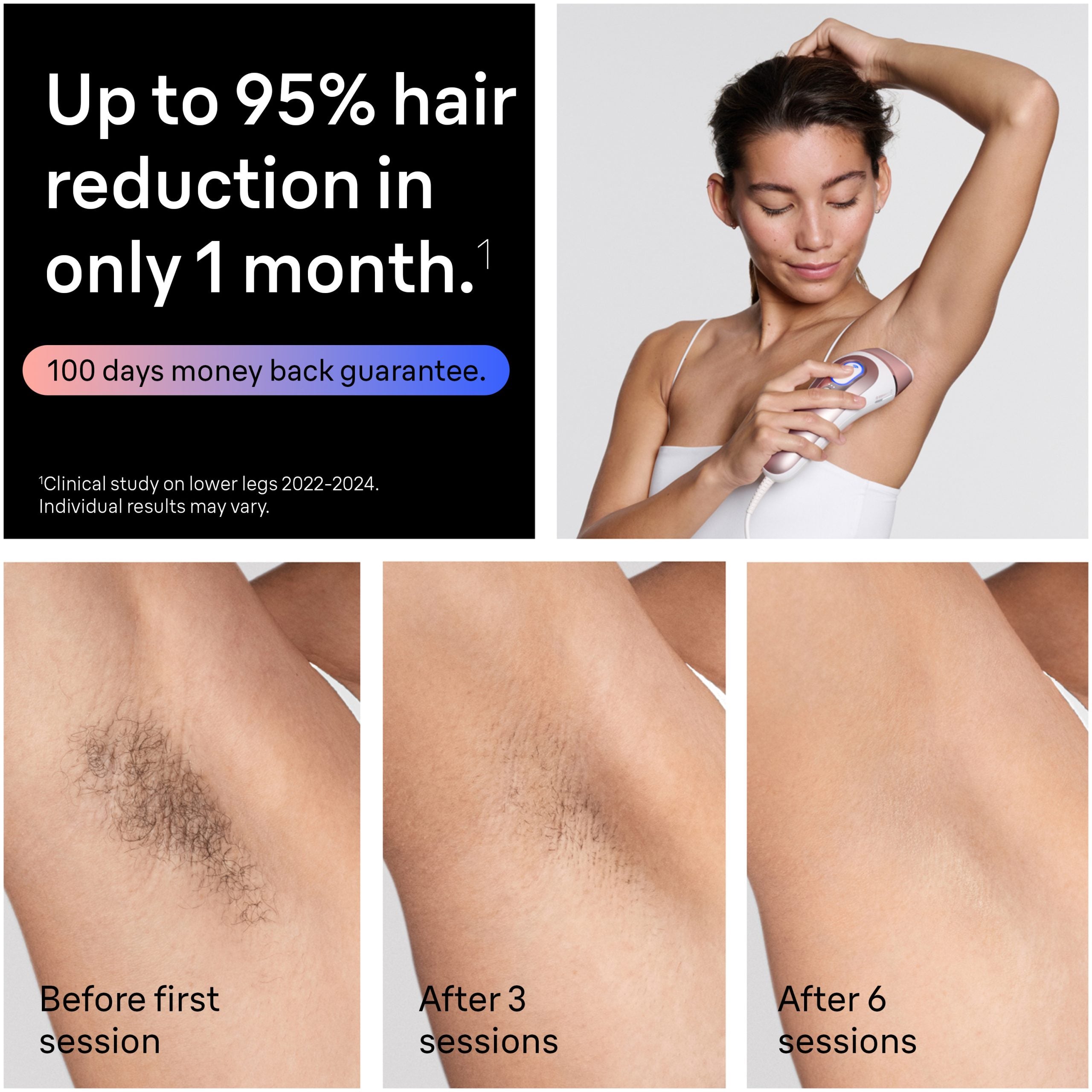 Braun Skin i·expert Smart IPL: At Home Alternative to Laser Hair Removal with 4 Caps and Vanity Case PL7387
